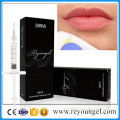 Reyoungel Injectable Hyaluronate Acid Dermal Filler for Lip Fullness